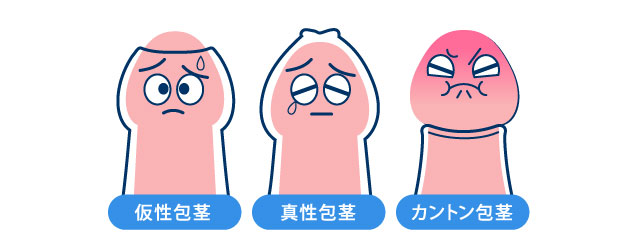 ��s�́A����̏�Ԃɂ��ȉ��̂R��ނɕ������܂�