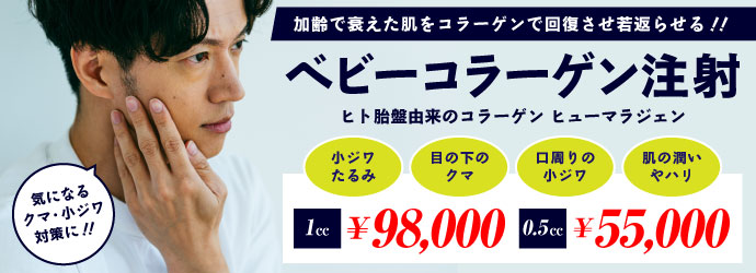 �j�̖ڂ̉��̃N�}�E���W����� �x�r�[�R���[�Q������