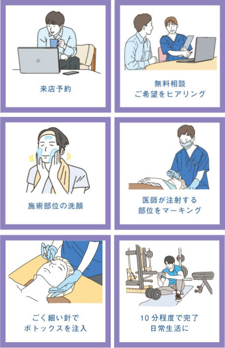 ボトックスの治療の流れ