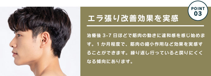 ボトックス注射のポイント