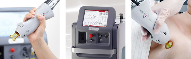 ジェントルレーズプロ