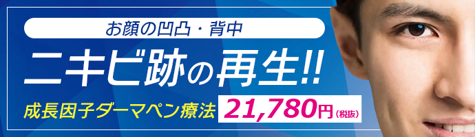 ニキビ跡の再生