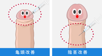 男性器増大PRP×FGF注射は新宿御苑メンズクリニックへ