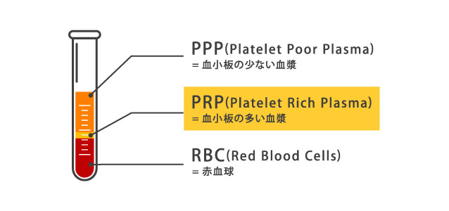 血小板血漿(PRP)とは?