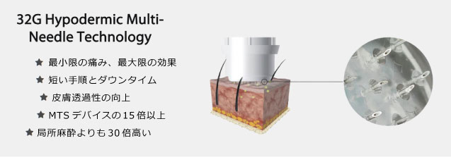 毛髪再生療法　成長因子グロースファクター