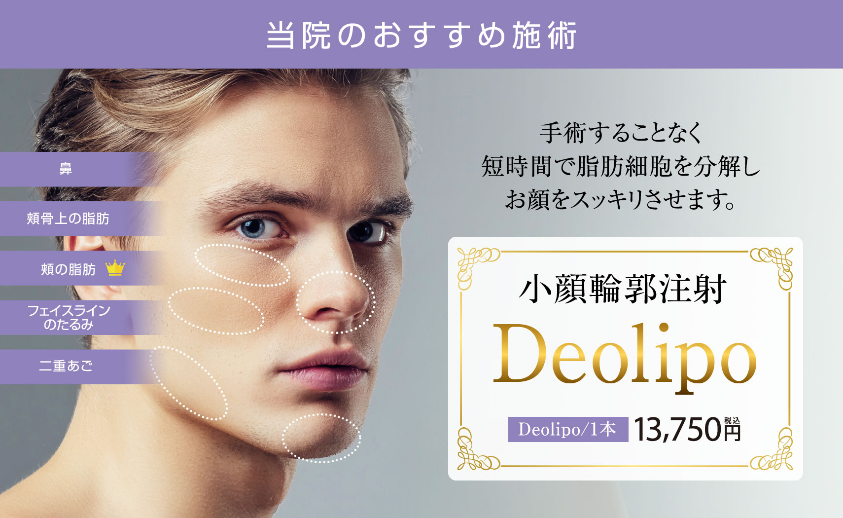 Deolipo（小顔輪郭注射）