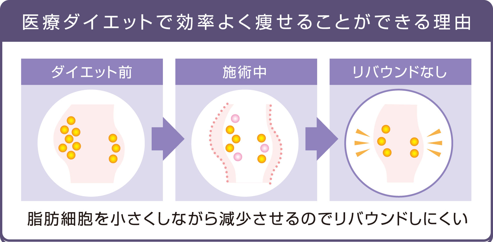 医療ダイエットで効率よく痩せることができる理由