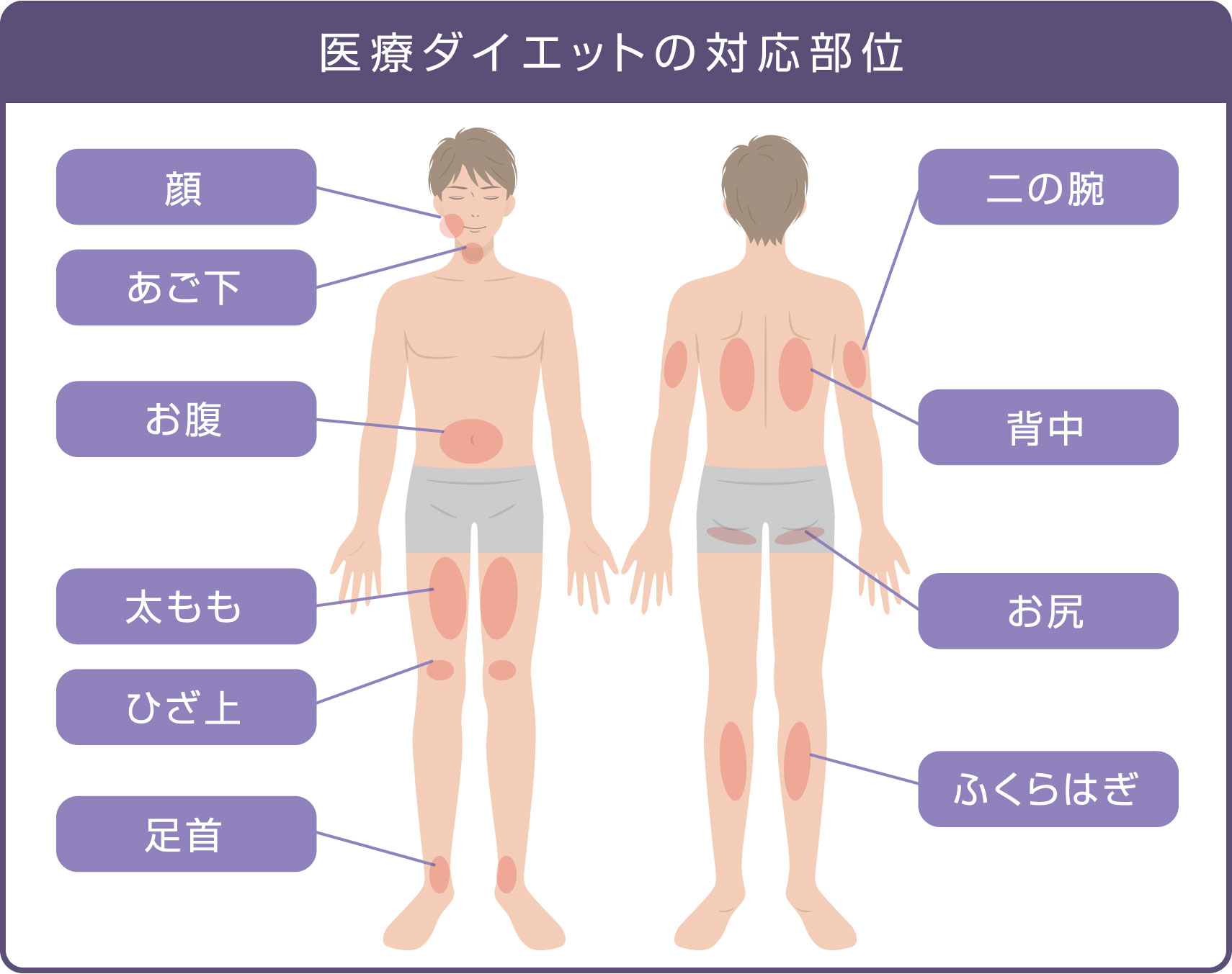 医療ダイエットの対応部位